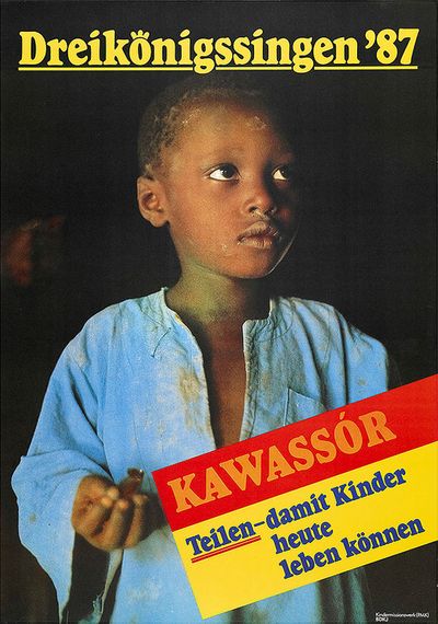 Ein Plakat zur Aktion Dreikönigssingen aus dem Jahr 1987. Abgebildet ist ein senegalesischer Junge in einem blauen Leinenhemd. Überall auf dem Körper und dem Hemd sind Schmutz und Dreck zu erkennen. In der rechten unteren Ecke ist ein Kasten indem etwas geschrieben steht. Rot unterlegt steht dort das senegalesische Wort Kawassór. Darunterr,  gelb unterlegt, steht Teilen- Damit Kinder heute leben können. Das Wort Teilen ist dabei mit zwei roten Strichen unterlegt. In der Kopfzeile des Plakats steht in gelber Schrift Dreikönigssingen ´87