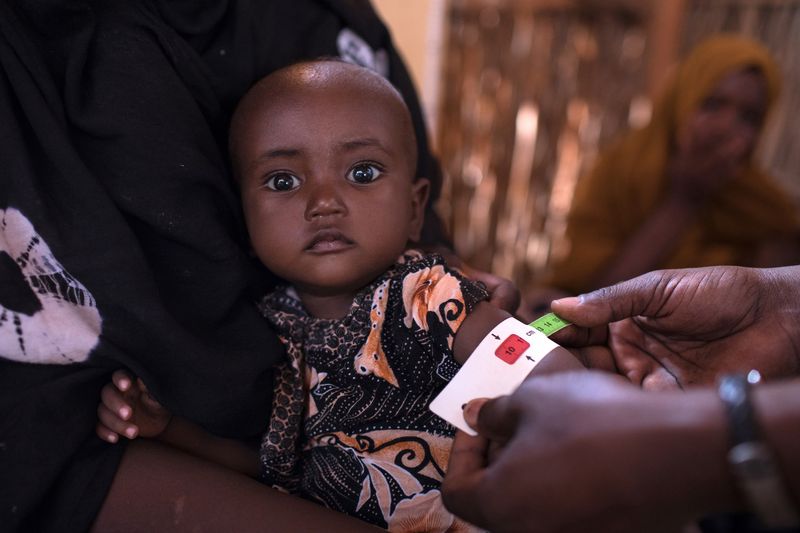 A Trocaire staff member screens a child for malnutrition at a mobile nutrition unit in the village of Surgadud in Dollo, Gedo region in South West Somalia on Monday, February 5, 2018. "Malnutrition cases are very high in these areas. For these people their priority changes with the priority of their animals. They keep moving looking for pasture, so for them their priority is livestock,” said Trocaire field coordinator Sugow Bishar Ahmed. With the support of Irish Aid, Trocaire has been able to conduct mobile nutrition screening, supplementary feeding and Outpatient Therapeutic Programs for isolated communities that lack basic medical services in South West Somalia.