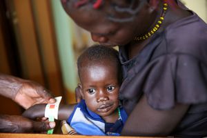 Yak Atiam with his mother Ayak Thiep at wellness clinic in St. Daniel Comboni Hospital, Wau